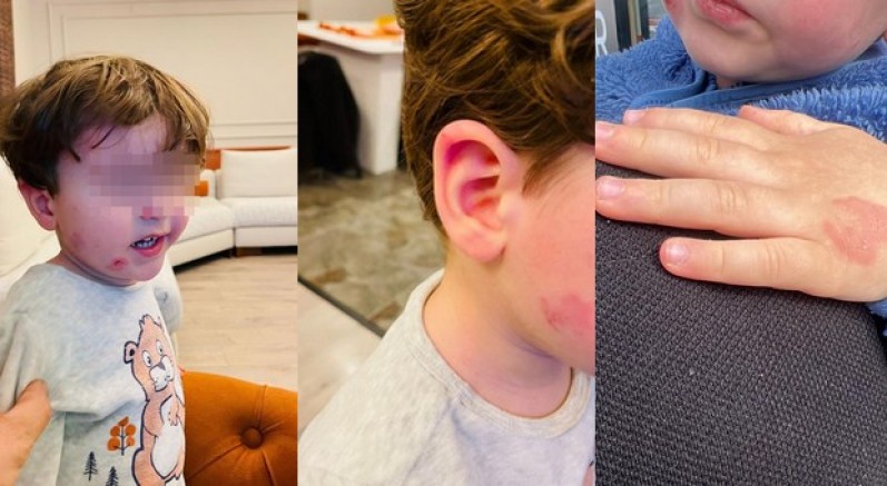 2 yaşındaki çocuk kreşte darp edildi