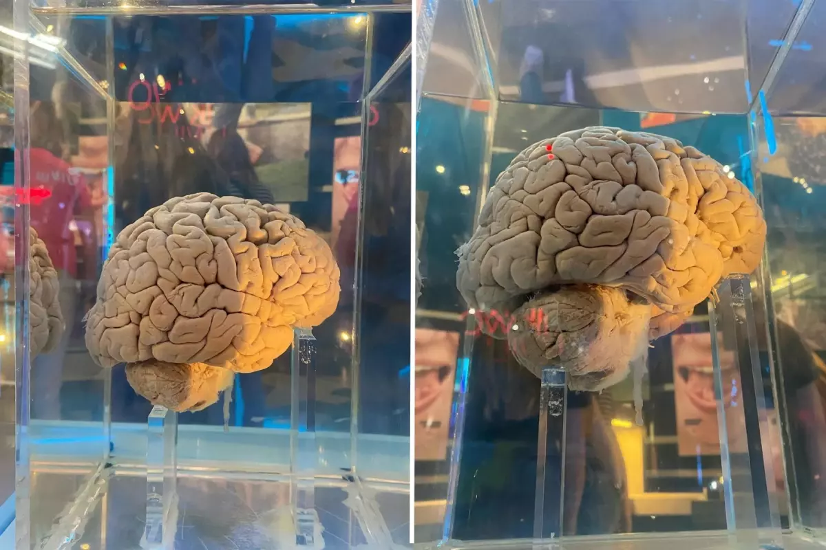 Amsterdam'daki dev arşiv: 5 bin 300 beyin yapay zeka ile haritalanacak