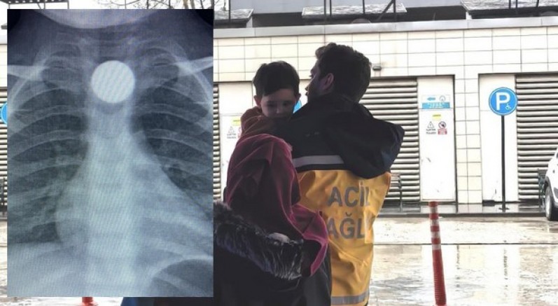 Bursa'da küçük çocuğun boğazına 50 kuruş kaçtı