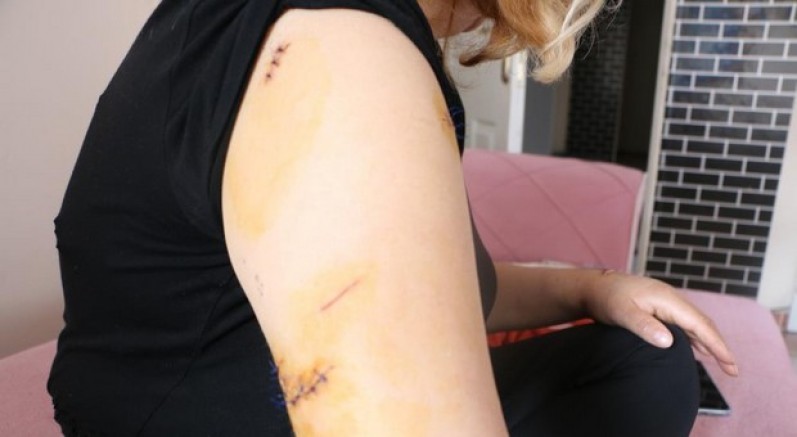 Eşini 30 yerinden bıçakladı