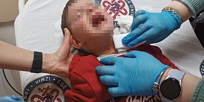 2 yaşındaki çocuğa bıçaklı saldırı