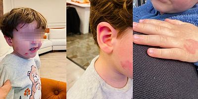 2 yaşındaki çocuk kreşte darp edildi