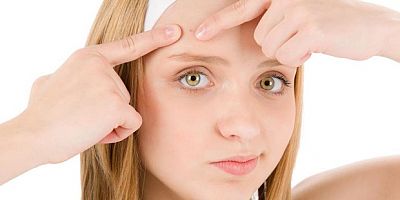 Akneleriniz bir daha ortaya çıkabilir