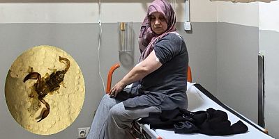 Akrep sokan kadın hastanelik oldu