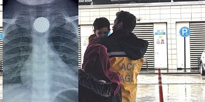 Bursa'da küçük çocuğun boğazına 50 kuruş kaçtı