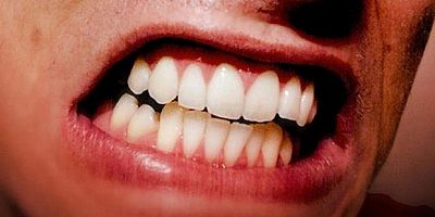 Çenede oluşan ağrıya dikkat