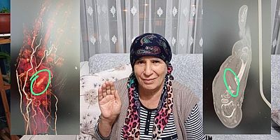 Elinin içinde odun parçası unutuldu