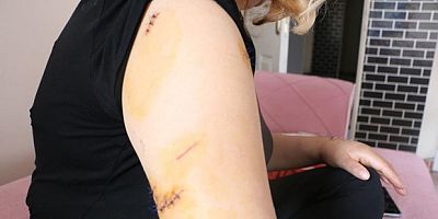 Eşini 30 yerinden bıçakladı