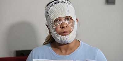 Güzelleşmek uğruna gittiği merkezde yüzü yandı