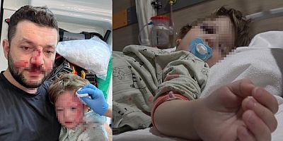 Komşuların gürültü kavgasında 14 aylık bebek hastanelik oldu