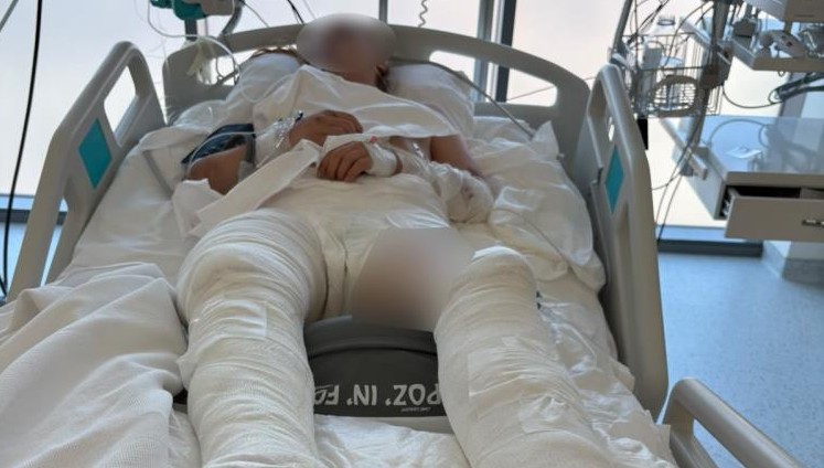 Otomobilin çarpıp üzerinden geçtiği genç kız ağır yaralandı