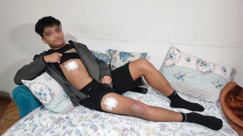Akran zorbalığı Önce dövüldü sonra bıçaklandı