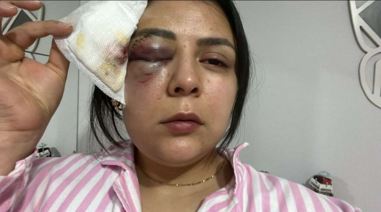 Bunu yapan insan olamaz; Yolda yürürken kadına saldırdılar