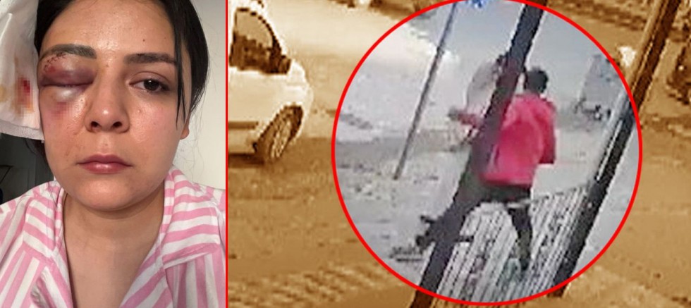 İnanılır gibi değil; Kadına saldıran o maganda serbest kaldı