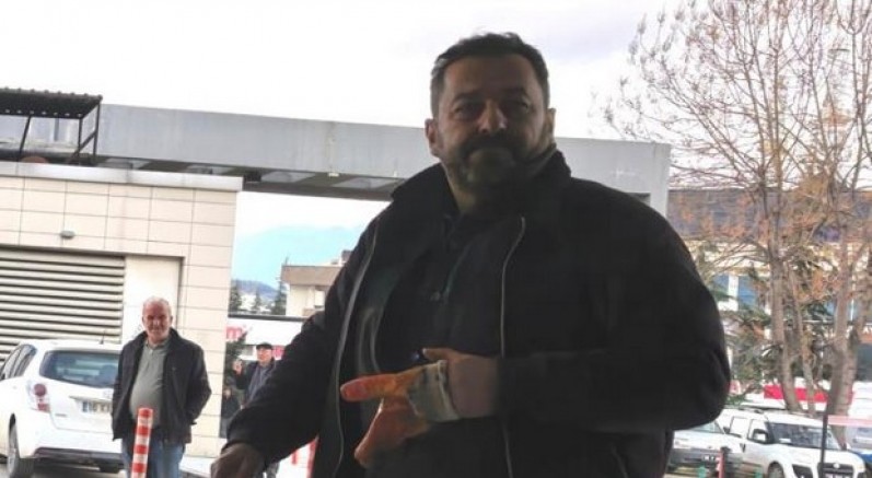İşçinin 2 parmağı koptu