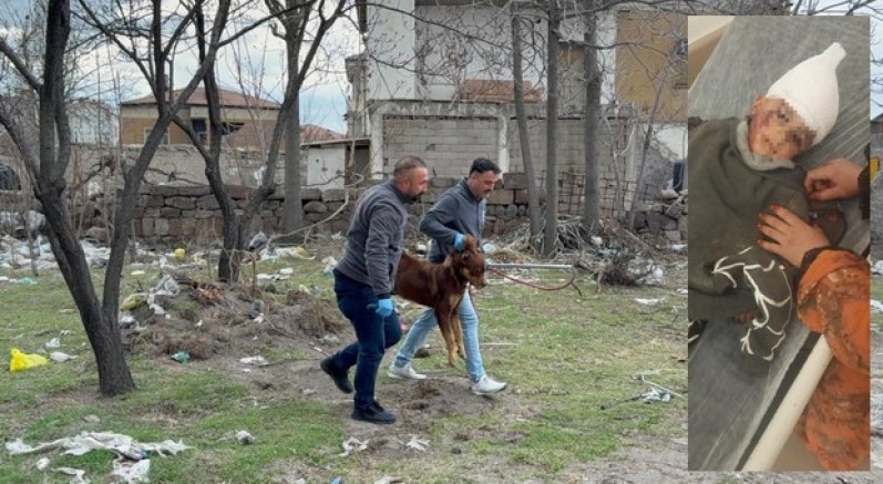 Köpeğin saldırısına uğrayan çocuk 3 operasyon geçirdi