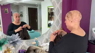 12 yaşında saçlarını ve kulaklarını kaybetti