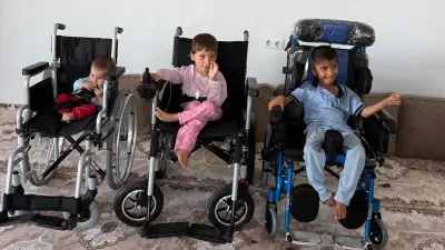 Kızılay’dan cam kemik hastası 3 kardeşe umut eli